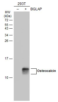 Non-transfected (–) and transfected (+) 293T whole cell extracts (30 μg) were separated by 15% SDS-PAGE, and the membrane was blotted with Osteocalcin antibody (GTX132902) diluted at 1:5000. The HRP-conjugated anti-rabbit IgG antibody (GTX213110-01) was used to detect the primary antibody.