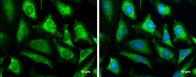 COX4I2 antibody detects COX4I2 protein at mitochondria by immunofluorescent analysis. Sample: HeLa cells were fixed in 4% paraformaldehyde at RT for 15 min. Green: COX4I2 stained by COX4I2 antibody (GTX132905) diluted at 1:1000. Blue: Hoechst 33342 staining. Scale bar= 10μm.