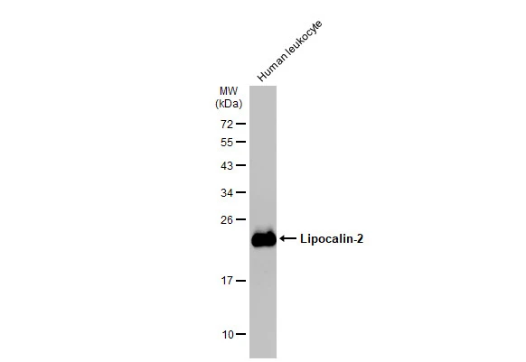 Human tissue extract (30 μg) was separated by 12% SDS-PAGE, and the membrane was blotted with Lipocalin-2 antibody (GTX132906) diluted at 1:1000. The HRP-conjugated anti-rabbit IgG antibody (GTX213110-01) was used to detect the primary antibody.