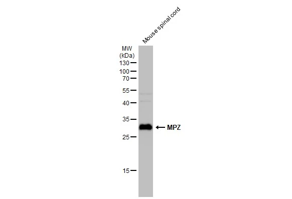 Mouse tissue extract (50 μg) was separated by 12% SDS-PAGE, and the membrane was blotted with MPZ antibody (GTX132911) diluted at 1:1000. The HRP-conjugated anti-rabbit IgG antibody (GTX213110-01) was used to detect the primary antibody.