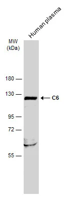 Human plasma (30 μg) was separated by 7.5% SDS-PAGE, and the membrane was blotted with C6 antibody (GTX132919) diluted at 1:1000. The HRP-conjugated anti-rabbit IgG antibody (GTX213110-01) was used to detect the primary antibody.