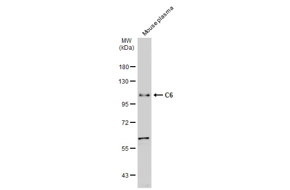 Mouse plasma (50 μg) was separated by 7.5% SDS-PAGE, and the membrane was blotted with C6 antibody (GTX132919) diluted at 1:1000. The HRP-conjugated anti-rabbit IgG antibody (GTX213110-01) was used to detect the primary antibody.