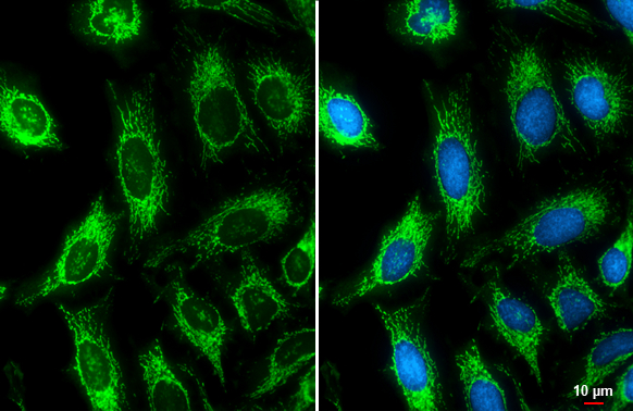 ATP5B antibody detects ATP5B protein at mitochondria by immunofluorescent analysis. Sample: HeLa cells were fixed in ice-cold MeOH for 5 min. Green: ATP5B stained by ATP5B antibody (GTX132925) diluted at 1:100. Blue: Hoechst 33342 staining. Scale bar= 10 μm.