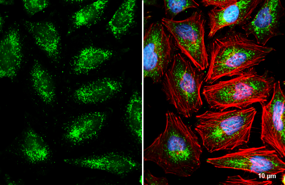 PMP70 antibody detects PMP70 protein at peroxisome by immunofluorescent analysis. Sample: HeLa cells were fixed in 4% paraformaldehyde at RT for 15 min. Green: PMP70 stained by PMP70 antibody (GTX132932) diluted at 1:1000. Red: phalloidin, a cytoskeleton marker, diluted at 1:200. Blue: Fluoroshield with DAPI (GTX30920). Scale bar= 10 μm.