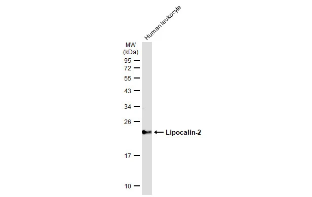 Lipocalin-2 antibody