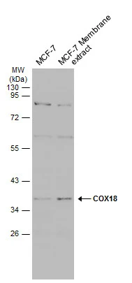 MCF-7 whole cell and membrane extracts (30 μg) were separated by 10% SDS-PAGE, and the membrane was blotted with COX18 antibody (GTX132940) diluted at 1:1000. The HRP-conjugated anti-rabbit IgG antibody (GTX213110-01) was used to detect the primary antibody.