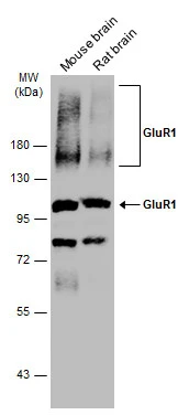 Various tissue extracts (50 μg) were separated by 7.5% SDS-PAGE, and the membrane was blotted with GluR1 antibody (GTX132945) diluted at 1:1000. The HRP-conjugated anti-rabbit IgG antibody (GTX213110-01) was used to detect the primary antibody. Various tissue extracts (50 μg) were separated by 7.5% SDS-PAGE, and the membrane was blotted with GluR1 antibody (GTX132945) diluted at 1:1000. The HRP-conjugated anti-rabbit IgG antibody (GTX213110-01) was used to detect the primary antibody.