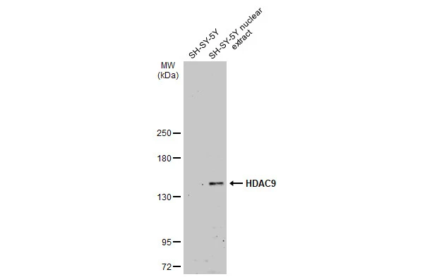 SH-SY5Y whole cell and nuclear extracts (30 μg) were separated by 5% SDS-PAGE, and the membrane was blotted with HDAC9 antibody (GTX132949) diluted at 1:500. The HRP-conjugated anti-rabbit IgG antibody (GTX213110-01) was used to detect the primary antibody, and the signal was developed with Trident ECL plus-Enhanced.