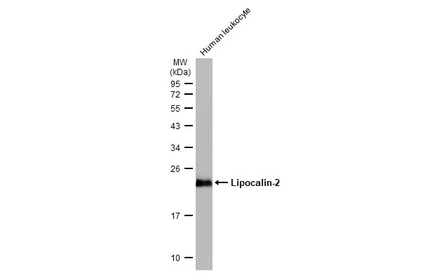 Lipocalin-2 antibody