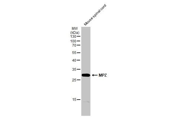 Mouse tissue extract (50 μg) was separated by 12% SDS-PAGE, and the membrane was blotted with MPZ antibody (GTX132954) diluted at 1:1000. The HRP-conjugated anti-rabbit IgG antibody (GTX213110-01) was used to detect the primary antibody.