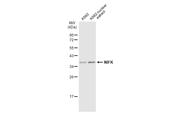 K562 whole cell and nuclear extracts (30 μg) were separated by 12% SDS-PAGE, and the membrane was blotted with NIFK antibody (GTX132955) diluted at 1:1000. The HRP-conjugated anti-rabbit IgG antibody (GTX213110-01) was used to detect the primary antibody.