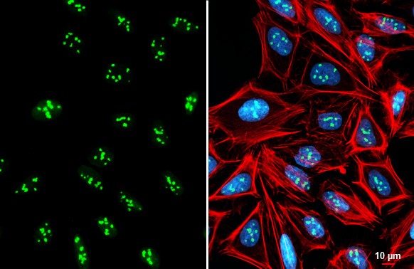 NIFK antibody detects NIFK protein at nucleolus by immunofluorescent analysis. Sample: U2OS cells were fixed in 4% paraformaldehyde at RT for 15 min. Green: NIFK stained by NIFK antibody (GTX132955) diluted at 1:1000. Red: phalloidin, a cytoskeleton marker, diluted at 1:200. Blue: Fluoroshield with DAPI (GTX30920). Scale bar= 10 μm.