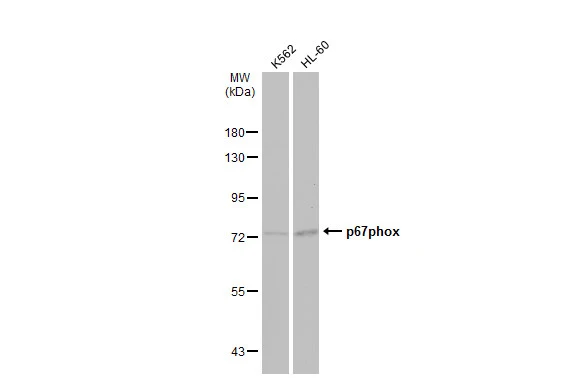 Various whole cell extracts (30 μg) were separated by 7.5% SDS-PAGE, and the membrane was blotted with p67phox antibody (GTX132967) diluted at 1:500. The HRP-conjugated anti-rabbit IgG antibody (GTX213110-01) was used to detect the primary antibody.