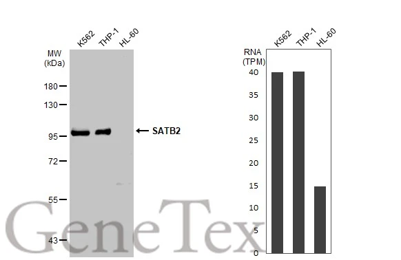 Various whole cell extracts (30 μg) were separated by 7.5% SDS-PAGE, and the membrane was blotted with SATB2 antibody (GTX132972) diluted at 1:1000. The HRP-conjugated anti-rabbit IgG antibody (GTX213110-01) was used to detect the primary antibody. Corresponding RNA expression data for the same cell lines are based on Human Protein Atlas program.