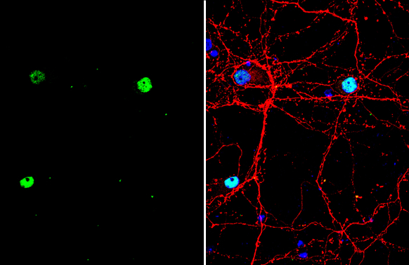 SATB2 antibody detects SATB2 protein by immunofluorescent analysis. Sample: DIV10 rat E18 primary cortical neuron cells were fixed in 4% paraformaldehyde at RT for 15 min. Green: SATB2 stained by SATB2 antibody (GTX132972) diluted at 1:500. Red: Tau, stained by Tau antibody [GT287] (GTX634809) diluted at 1:500. Blue: Fluoroshield with DAPI (GTX30920).