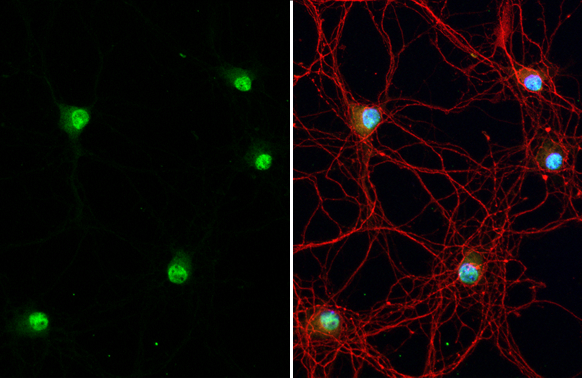 Anti-NeuN antibody (GTX132974) | GeneTex