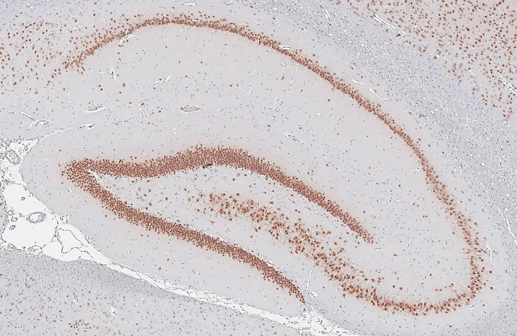 13枚組 RAAVO BERGLUND Anti-NeuN antibody (GTX132974) | GeneTex