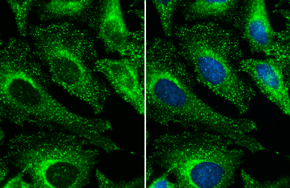 売れ筋新商品 Anti-Clathrin Heavy GeneTex | (GTX132976) antibody chain 帽子