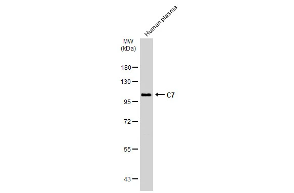 Human plasma (30 μg) was separated by 7.5% SDS-PAGE, and the membrane was blotted with C7 antibody (GTX132977) diluted at 1:1000. The HRP-conjugated anti-rabbit IgG antibody (GTX213110-01) was used to detect the primary antibody.