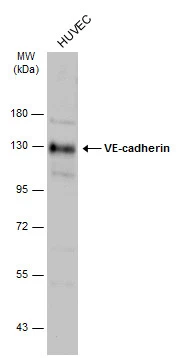 Whole cell extract (30 μg) was separated by 7.5% SDS-PAGE, and the membrane was blotted with VE-cadherin antibody (GTX132982) diluted at 1:2000. The HRP-conjugated anti-rabbit IgG antibody (GTX213110-01) was used to detect the primary antibody.