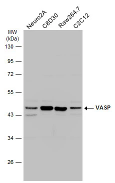 Various whole cell extracts (30 μg) were separated by 10% SDS-PAGE, and the membrane was blotted with VASP antibody (GTX132983) diluted at 1:1000. The HRP-conjugated anti-rabbit IgG antibody (GTX213110-01) was used to detect the primary antibody.