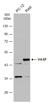 Various whole cell extracts (30 μg) were separated by 10% SDS-PAGE, and the membrane was blotted with VASP antibody (GTX132983) diluted at 1:1000. The HRP-conjugated anti-rabbit IgG antibody (GTX213110-01) was used to detect the primary antibody.