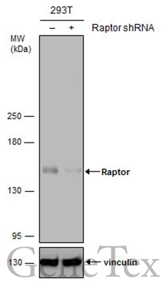Non-transfected (–) and transfected (+) 293T whole cell extracts (30 μg) were separated by 5% SDS-PAGE, and the membrane was blotted with Raptor antibody (GTX132989) diluted at 1:1000. The HRP-conjugated anti-rabbit IgG antibody (GTX213110-01) was used to detect the primary antibody.