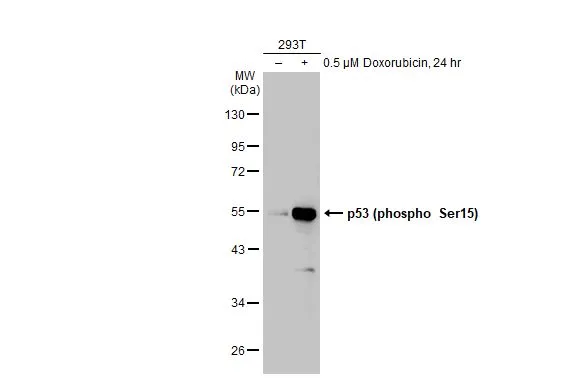 Untreated (–) and treated (+) 293T whole cell extracts (30 μg) were separated by 10% SDS-PAGE, and the membrane was blotted with p53 (phospho Ser15) antibody (GTX132995) diluted at 1:1000. The HRP-conjugated anti-rabbit IgG antibody (GTX213110-01) was used to detect the primary antibody. Untreated (–) and treated (+) 293T whole cell extracts (30 μg) were separated by 10% SDS-PAGE, and the membrane was blotted with p53 (phospho Ser15) antibody (GTX132995) diluted at 1:1000. The HRP-conjugated anti-rabbit IgG antibody (GTX213110-01) was used to detect the primary antibody.