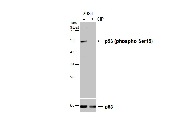 Untreated (–) and treated (+) 293T whole cell extracts (30 μg) were separated by 10% SDS-PAGE, and the membrane was blotted with p53 (phospho Ser15) antibody (GTX132995) diluted at 1:1000. The HRP-conjugated anti-rabbit IgG antibody (GTX213110-01) was used to detect the primary antibody. Untreated (–) and treated (+) 293T whole cell extracts (30 μg) were separated by 10% SDS-PAGE, and the membrane was blotted with p53 (phospho Ser15) antibody (GTX132995) diluted at 1:1000. The HRP-conjugated anti-rabbit IgG antibody (GTX213110-01) was used to detect the primary antibody.