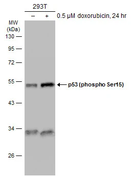 Untreated (–) and treated (+) 293T whole cell extracts (30 μg) were separated by 10% SDS-PAGE, and the membrane was blotted with p53 (phospho Ser46) antibody (GTX132996) diluted at 1:1000. The HRP-conjugated anti-rabbit IgG antibody (GTX213110-01) was used to detect the primary antibody.