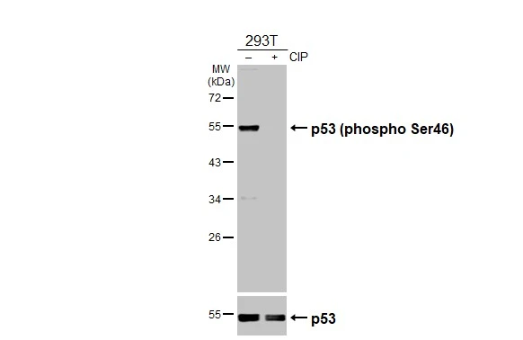 Untreated (–) and treated (+) 293T whole cell extracts (30 μg) were separated by 10% SDS-PAGE, and the membrane was blotted with p53 (phospho Ser46) antibody (GTX132996) diluted at 1:1000. The HRP-conjugated anti-rabbit IgG antibody (GTX213110-01) was used to detect the primary antibody. Untreated (–) and treated (+) 293T whole cell extracts (30 μg) were separated by 10% SDS-PAGE, and the membrane was blotted with p53 (phospho Ser46) antibody (GTX132996) diluted at 1:1000. The HRP-conjugated anti-rabbit IgG antibody (GTX213110-01) was used to detect the primary antibody.