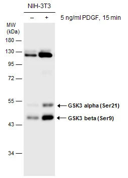 上品なファッション Anti-GSK3 Ser9 (phospho beta GSK3 + Ser21) (phospho alpha 鍵盤楽器、ピアノ