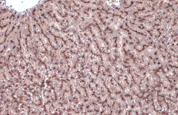 Cathepsin A antibody detects Cathepsin A protein at cytoplasm by immunohistochemical analysis. Sample: Paraffin-embedded mouse liver. Cathepsin A stained by Cathepsin A antibody (GTX133016) diluted at 1:1000. Antigen Retrieval: Citrate buffer, pH 6.0, 15 min Cathepsin A antibody detects Cathepsin A protein at cytoplasm by immunohistochemical analysis. Sample: Paraffin-embedded mouse liver. Cathepsin A stained by Cathepsin A antibody (GTX133016) diluted at 1:1000. Antigen Retrieval: Citrate buffer, pH 6.0, 15 min