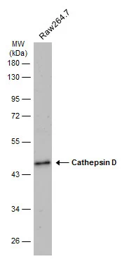 Whole cell extract (30 μg) was separated by 10% SDS-PAGE, and the membrane was blotted with Cathepsin D antibody (GTX133019) diluted at 1:500. The HRP-conjugated anti-rabbit IgG antibody (GTX213110-01) was used to detect the primary antibody.