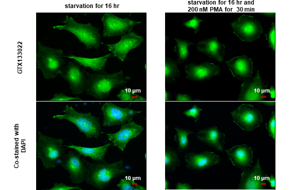 Connexin 43 antibody detects Connexin 43 protein at cell membrane by immunofluorescent analysis. Sample: HeLa cells were fixed in 4% paraformaldehyde at RT for 15 min. Green: Connexin 43 stained by Connexin 43 antibody (GTX133022) diluted at 1:1000. Blue: Fluoroshield with DAPI (GTX30920). Scale bar= 10 μm.