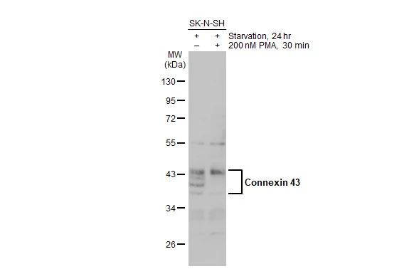 Untreated (–) and treated (+) SK-N-SH whole cell extracts (30 μg) were separated by 10% SDS-PAGE, and the membrane was blotted with Connexin 43 antibody (GTX133022) diluted at 1:500. The HRP-conjugated anti-rabbit IgG antibody (GTX213110-01) was used to detect the primary antibody.
