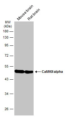 Various tissue extracts (50 μg) were separated by 10% SDS-PAGE, and the membrane was blotted with CaMKII alpha antibody (GTX133071) diluted at 1:1000. The HRP-conjugated anti-rabbit IgG antibody (GTX213110-01) was used to detect the primary antibody.