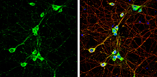CaMKII alpha antibody detects CaMKII alpha protein by immunofluorescent analysis. Sample: DIV9 rat E18 primary hippocampal neuron cells were fixed in 4% paraformaldehyde at RT for 15 min. Green: CaMKII alpha stained by CaMKII alpha antibody (GTX133071) diluted at 1:500. Red: beta Tubulin 3/ Tuj1, stained by beta Tubulin 3/ Tuj1 antibody [GT11710] (GTX631836) diluted at 1:500. Blue: Fluoroshield with DAPI (GTX30920).