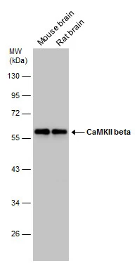 Various tissue extracts (30 μg) were separated by 10% SDS-PAGE, and the membrane was blotted with CaMKII beta antibody (GTX133072) diluted at 1:1000. Various tissue extracts (30 μg) were separated by 10% SDS-PAGE, and the membrane was blotted with CaMKII beta antibody (GTX133072) diluted at 1:1000.