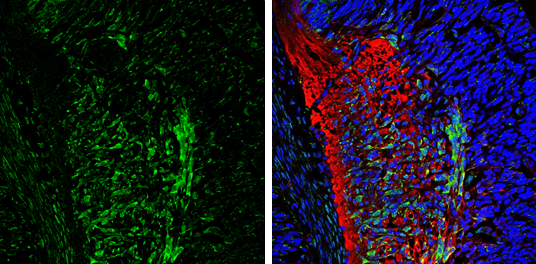 CaMKII beta antibody detects CaMKII beta protein expression by immunohistochemical analysis. Sample: Frozen sectioned E13.5 Rat brain. Green: CaMKII beta protein stained by CaMKII beta antibody (GTX133072) diluted at 1:250. Red: beta Tubulin 3/ TUJ1, a mature neuron marker, stained by beta Tubulin 3/ TUJ1 antibody [GT11710] (GTX631836) diluted at 1:500. Blue: Fluoroshield with DAPI (GTX30920).