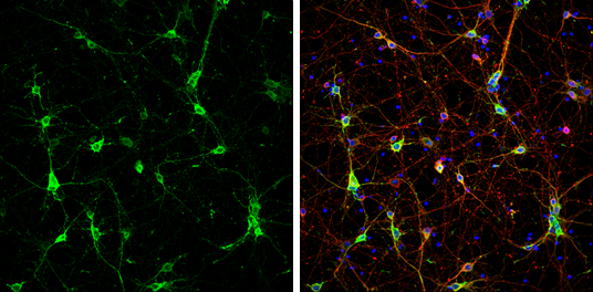 CaMKII beta antibody detects CaMKII beta protein at cytoplasm by immunofluorescent analysis. Sample: DIV9 rat E18 primary cortical neurons were fixed in 4% paraformaldehyde at RT for 15 min. Green: CaMKII beta protein stained by CaMKII beta antibody (GTX133072) diluted at 1:500. Red: beta Tubulin 3/ Tuj1, stained by beta Tubulin 3/ Tuj1 antibody [GT11710] (GTX631836) diluted at 1:500. Blue: Fluoroshield with DAPI (GTX30920).