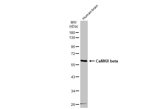 Human tissue extract (30 μg) was separated by 10% SDS-PAGE, and the membrane was blotted with CaMKII beta antibody (GTX133072) diluted at 1:500. The HRP-conjugated anti-rabbit IgG antibody (GTX213110-01) was used to detect the primary antibody. Human tissue extract (30 μg) was separated by 10% SDS-PAGE, and the membrane was blotted with CaMKII beta antibody (GTX133072) diluted at 1:500. The HRP-conjugated anti-rabbit IgG antibody (GTX213110-01) was used to detect the primary antibody.
