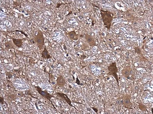 NMDAR1 antibody detects NMDAR1 protein at cytoplasm in rat brain by immunohistochemical analysis. Sample: Paraffin-embedded rat brain. NMDAR1 antibody (GTX133097) diluted at 1:400.  Antigen Retrieval: Citrate buffer,pH 6.0,15 min
