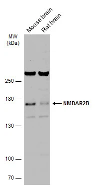 Various tissue extracts (50 μg) were separated by 5% SDS-PAGE, and the membrane was blotted with NMDAR2B antibody (GTX133099) diluted at 1:1000. The HRP-conjugated anti-rabbit IgG antibody (GTX213110-01) was used to detect the primary antibody.