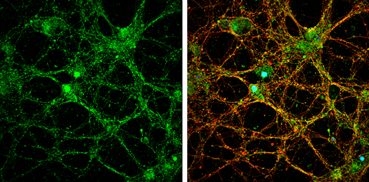 NMDAR2B antibody detects NMDAR2B protein by immunofluorescent analysis. Sample: DIV14 rat E18 primary cortical neurons were fixed in 4% paraformaldehyde at RT for 15 min. Green: NMDAR2B protein stained by NMDAR2B antibody (GTX133099) diluted at 1:500. Red: beta Tubulin 3/ Tuj1, stained by beta Tubulin 3/ Tuj1 antibody [GT1338] (GTX631831) diluted at 1:500. Blue: Fluoroshield with DAPI (GTX30920).