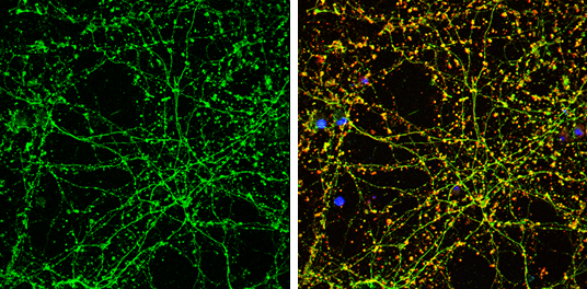 KARDIAN  SEROTONIN ORIGIN S.T. カージアン Serotonin Supplement | Allergy Research Group