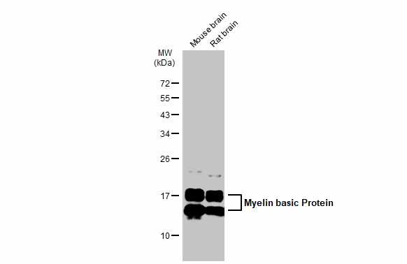 Myelin Basic Protein antibody detects Myelin Basic Protein protein at cytoplasm in rat brain by immunohistochemical analysis.