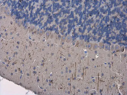 Anti-MAP2 antibody (GTX133109) | GeneTex