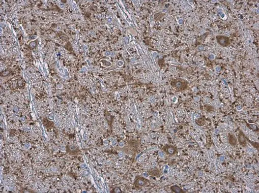 maplay様 Anti-MAP2 antibody (GTX133109) | GeneTex
