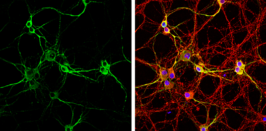 MAP2 antibody detects MAP2 protein at by immunofluorescent analysis. Sample: DIV9 rat E18 primary cortical neurons were fixed in 4% paraformaldehyde at RT for 15 min. Green: MAP2 protein stained by MAP2 antibody (GTX133110) diluted at 1:500. Red: Tau, stained by Tau antibody (GTX49353) diluted at 1:1000. Blue: Fluoroshield with DAPI (GTX30920). MAP2 antibody detects MAP2 protein at by immunofluorescent analysis. Sample: DIV9 rat E18 primary cortical neurons were fixed in 4% paraformaldehyde at RT for 15 min. Green: MAP2 protein stained by MAP2 antibody (GTX133110) diluted at 1:500. Red: Tau, stained by Tau antibody (GTX49353) diluted at 1:1000. Blue: Fluoroshield with DAPI (GTX30920).